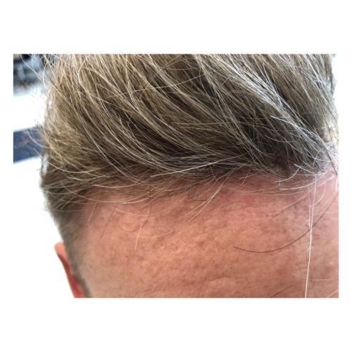 Contact skin, ingen vil "spotte" der er limet hår på toppen.
